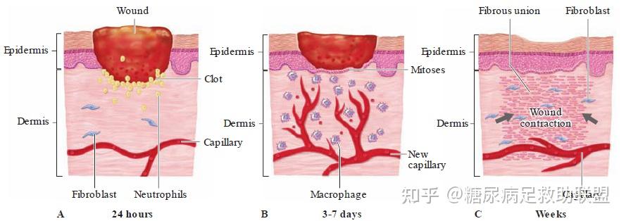 反应启动整个愈合过程,逐步实现肉芽组织的增生填充缺损组织的部位