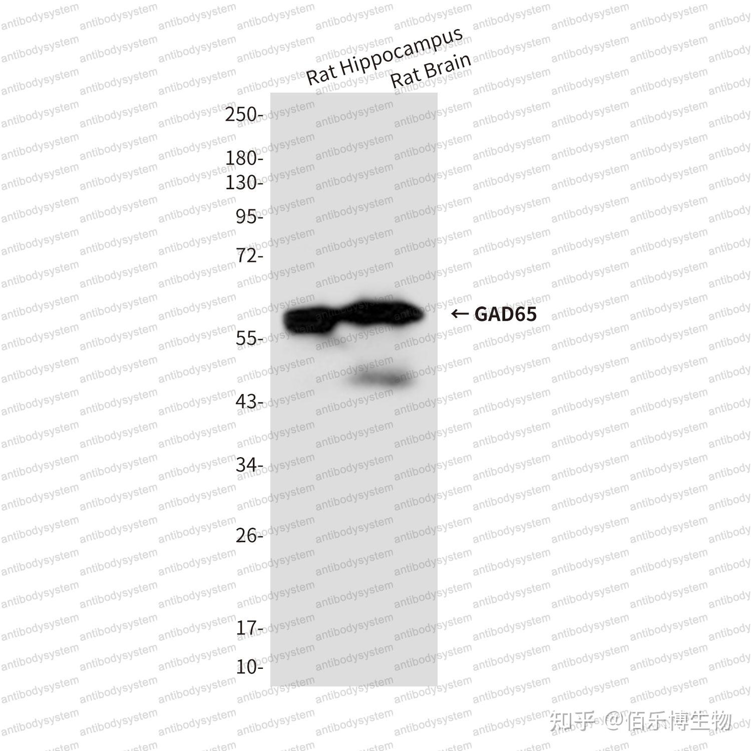佰乐博生物蛋白抗体——GAD65（谷氨酸脱羧酶65） - 知乎