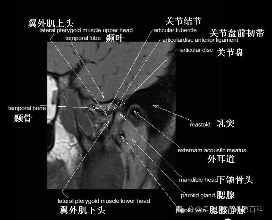 颞颌关节解剖及高清影像 - 知乎
