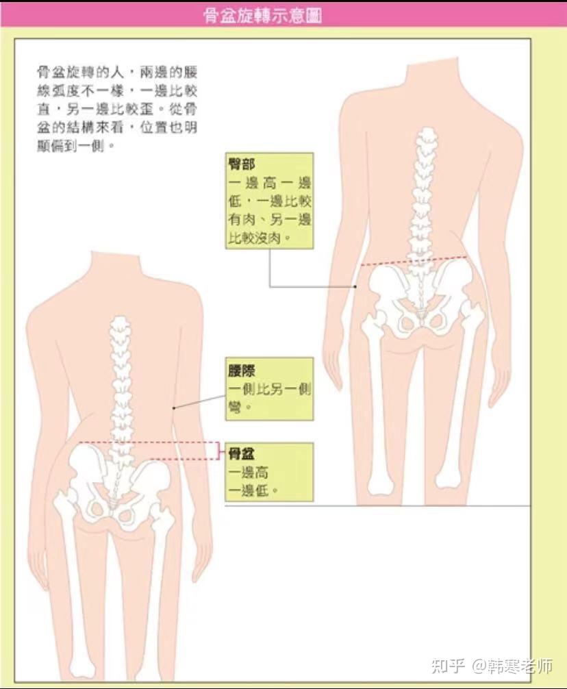 骨盆前后位图片