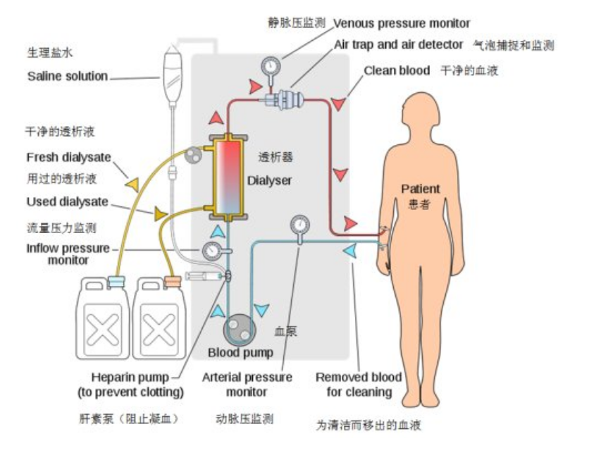图表5-24  血液透析流程及相关器械示意