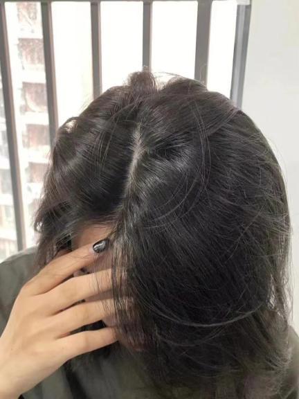 而且对长期压力过大,精神焦虑引起的白头发效果也不错!