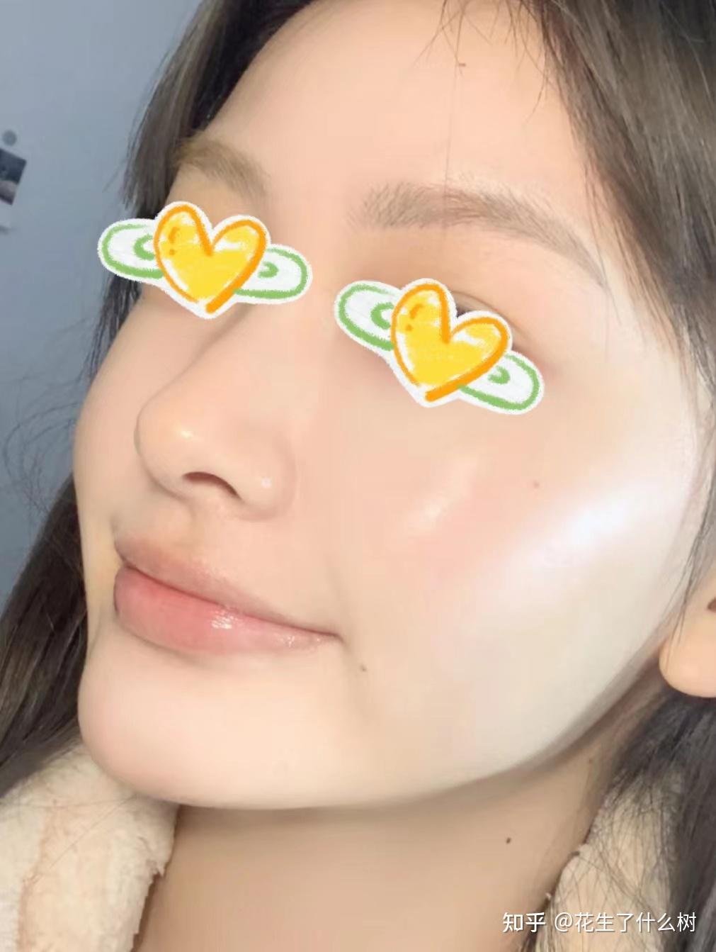 油痘肌告诉你,夏天用什么水乳最合适! - 知乎