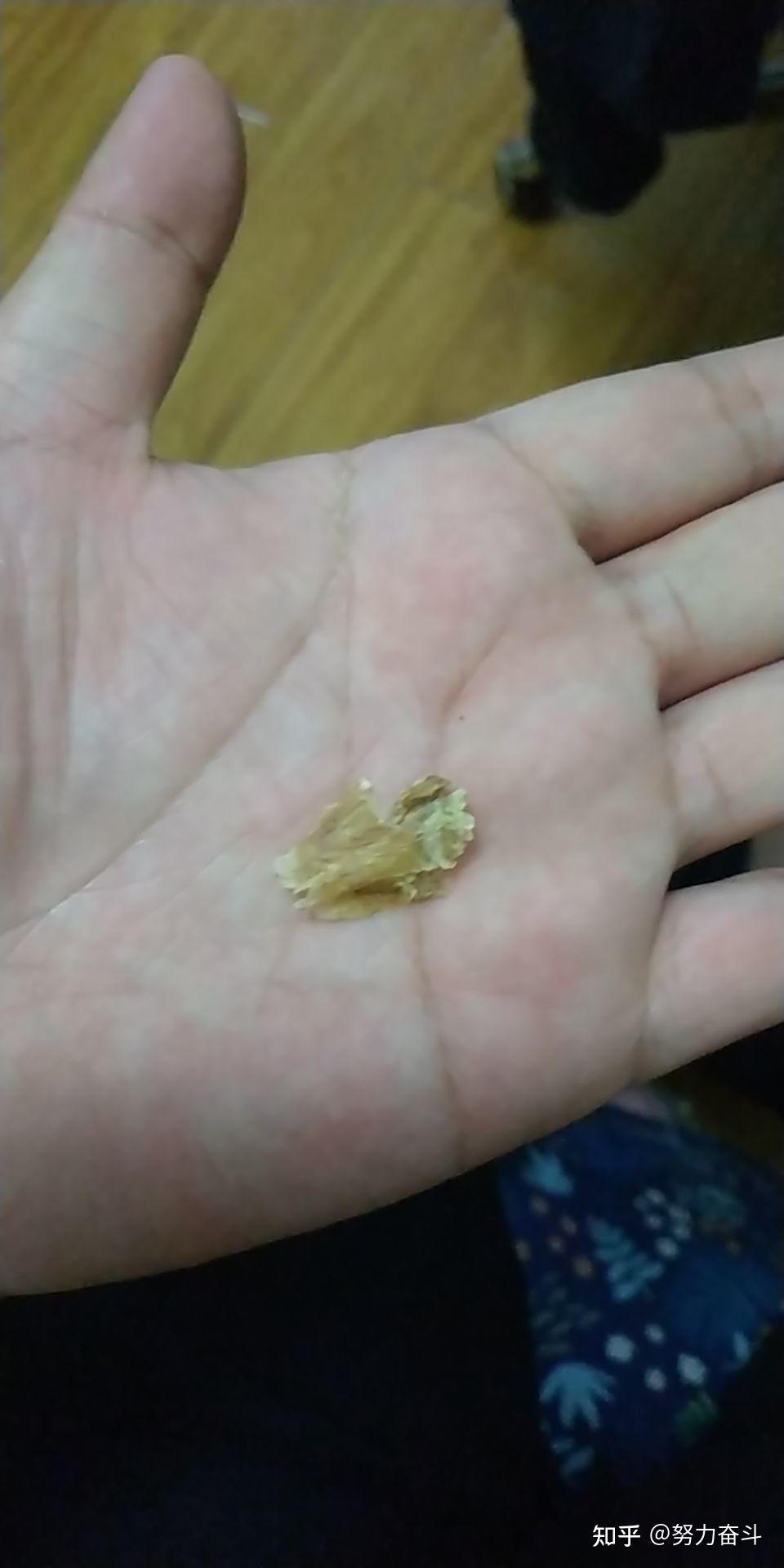 掏出一块超大耳屎,是种什么体验? - 知乎