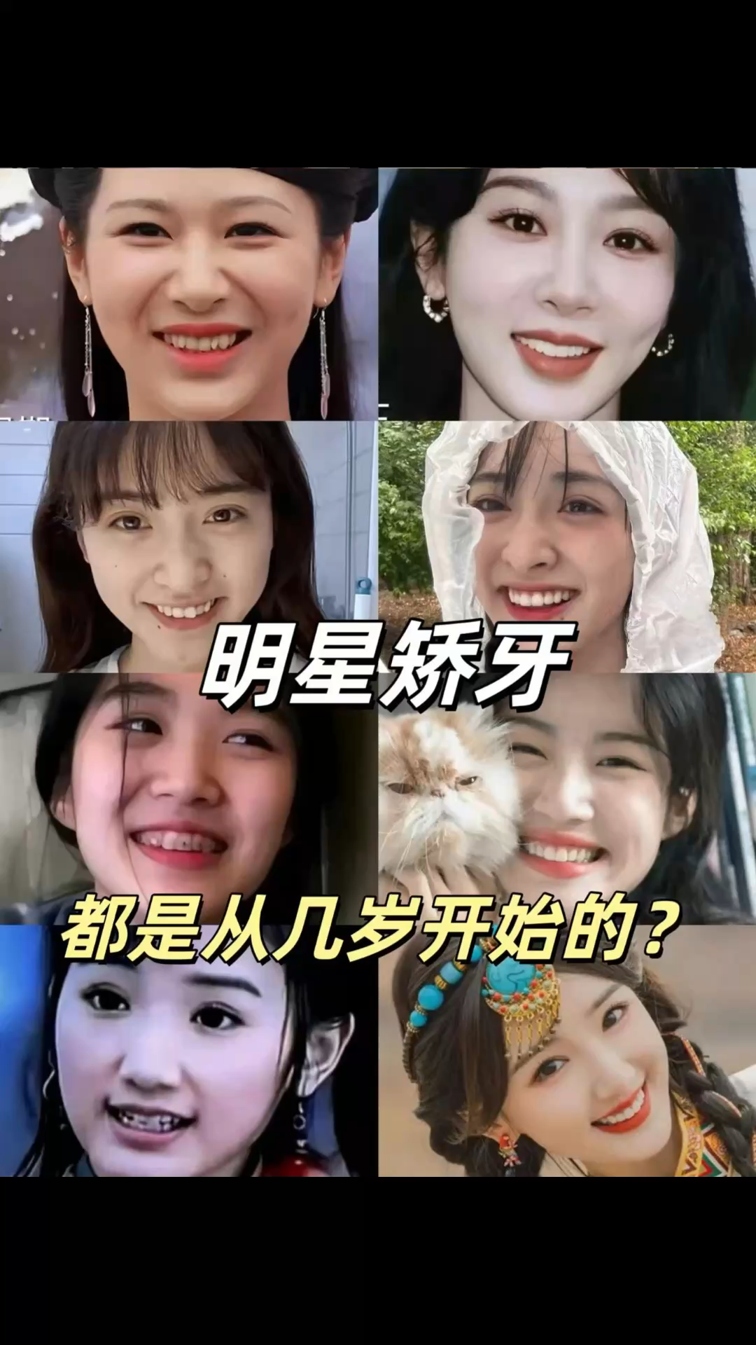 几岁带牙套才合适来看看这些明星是怎么做的