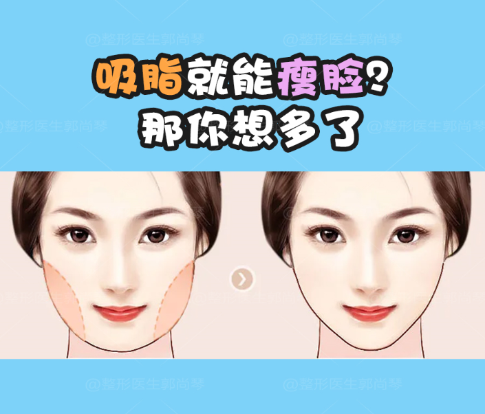 怎么才能瘦脸最简单 v2-ff73c9fd42188cda0f7e04d7e54f503c_1440w.jpg?source=172ae18b