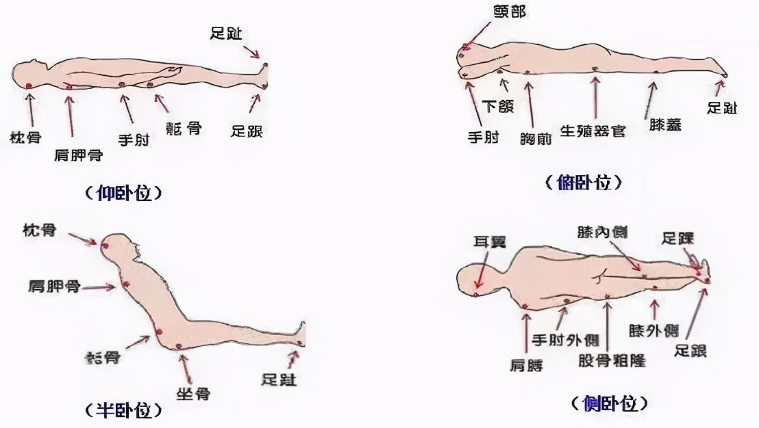 ①定时翻身,每1