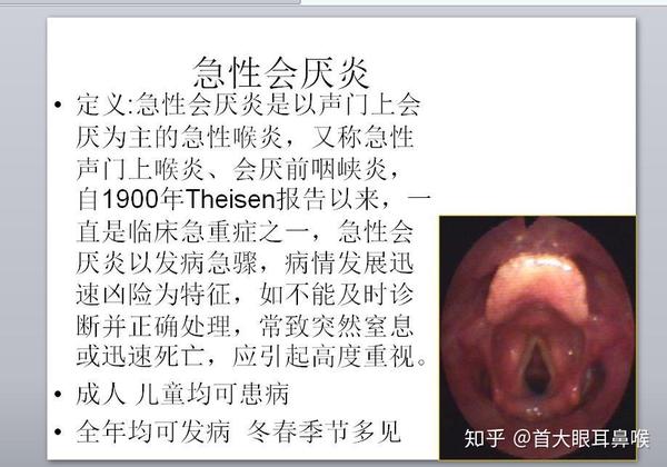 首大宋发全:咽痛时需谨防急性会厌炎 - 知乎