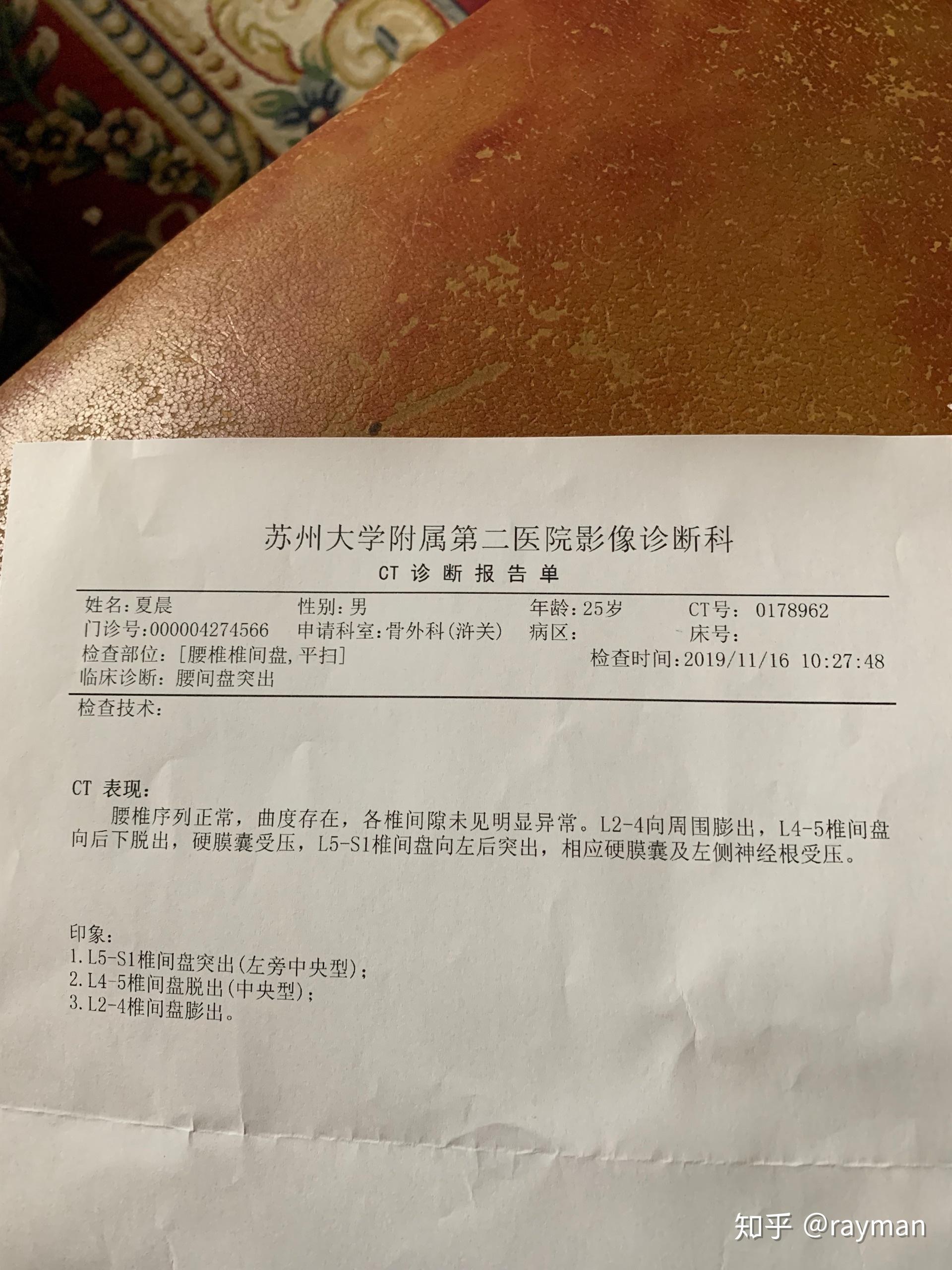腰间盘突出能自愈吗