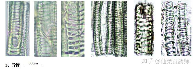 梯纹导管显微图图片