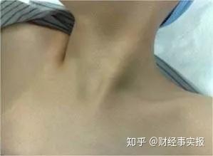v2-ffd1e8b37647475eefaef62d5c36ca9c_b.jpg